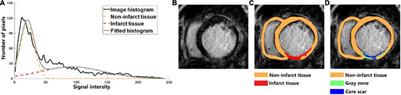 Preliminary Study: Learning the Impact of Simulation Time on Reentry Location and Morphology Induced by Personalized Cardiac Modeling